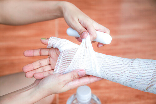 What Should I Know About Burn Injuries